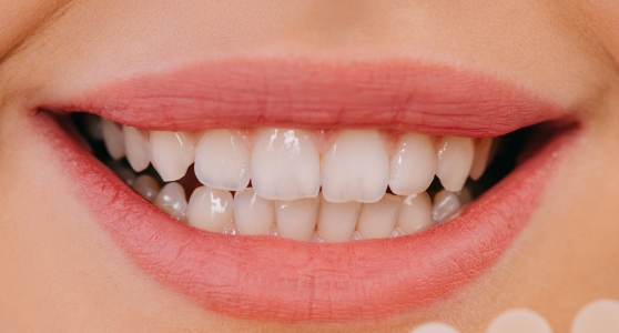 Dental procedure after