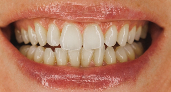 Dental procedure before